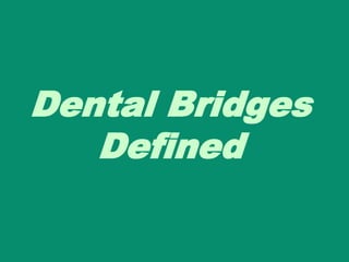 Dental Bridges
   Defined
 