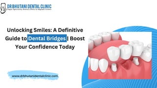www.drbhutanidentalclinic.com
Unlocking Smiles: A Definitive
Guide to Dental Bridges | Boost
Your Confidence Today
 