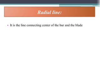 Radial line:
• It is the line connecting center of the bur and the blade
 