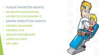 Dental calculus | PPTX