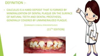 Dental calculus | PPTX