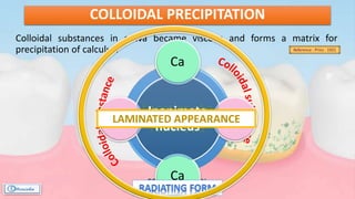 Colloidal substances in saliva became viscous and forms a matrix for
precipitation of calculus.
COLLOIDAL PRECIPITATION
Reference : Prinz - 1921
Inanimate
Nucleus
Inanimate
nucleus
Ca
Mg
Ca
MgLAMINATED APPEARANCE
 