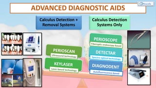 ADVANCED DIAGNOSTIC AIDS
Calculus Detection +
Removal Systems
Calculus Detection
Systems Only
 