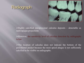 Highly calcified interproximal calculus deposits - detectable as
radioopaque projections
However, the sensitivity level of calculus detection by radiographs
is low.
The location of calculus does not indicate the bottom of the
periodontal pocket because the most apical plaque is not sufficiently
calcified to be visible on radiographs.
 