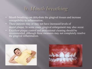 • Mouth breathing can dehydrate the gingival tissues and increase
susceptibility to inflammation.
• These patients may or may not have increased levels of
dental plaque. In some cases, gingival enlargement may also occur.
• Excellent plaque control and professional cleaning should be
recommended, although these measures may not completely resolve
the gingival inflammation.
 