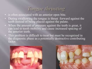• is often associated with an anterior open bite.
• During swallowing the tongue is thrust forward against the
teeth instead of being placed against the palate.
• When the amount of pressure against the teeth is great, it
can lead to tooth mobility and cause increased spacing of
the anterior teeth.
• This problem is difficult to treat but must be recognized in
the diagnostic phase as a potentially destructive contributing
factor.
 