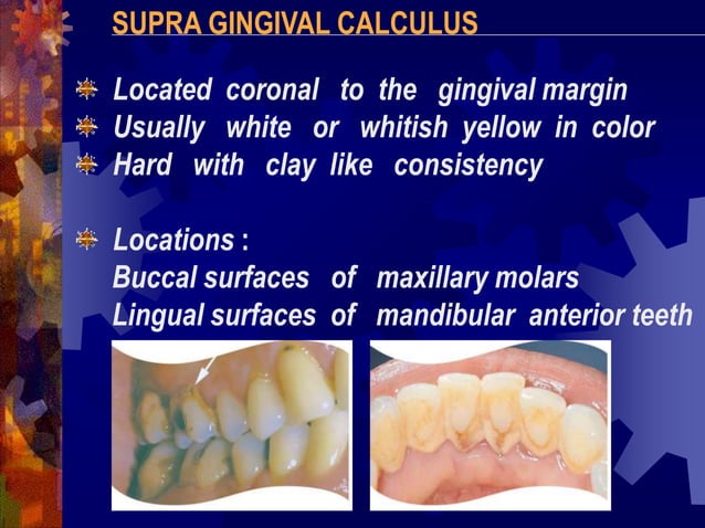 DENTAL CALCULUS.ppt