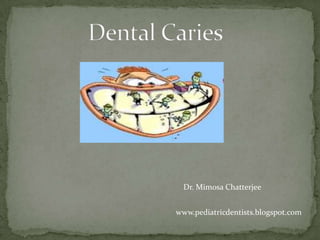 Dr. Mimosa Chatterjee


www.pediatricdentists.blogspot.com
 