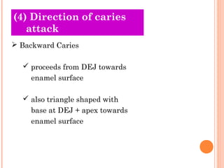 (O4l)d D Tirheecotriioens of caries 
attack 
 Backward Caries 
 proceeds from DEJ towards 
enamel surface 
 also triangle shaped with 
base at DEJ + apex towards 
enamel surface 
 