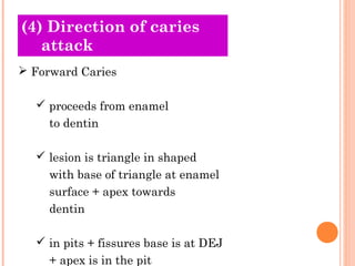 (4) Direction
Old Theories of caries
   attack
 Forward Caries

   proceeds from enamel
     to dentin

   lesion is triangle in shaped
     with base of triangle at enamel
     surface + apex towards
     dentin

   in pits + fissures base is at DEJ
     + apex is in the pit
 