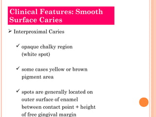 Clinical Features: Smooth
Surface Caries
 Interproximal Caries

    opaque chalky region
     (white spot)

    some cases yellow or brown
     pigment area

    spots are generally located on
     outer surface of enamel
     between contact point + height
     of free gingival margin
 