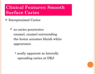 Clinical Features: Smooth
Surface Caries
 Interproximal Caries

    as caries penetrates
     enamel, enamel surrounding
     the lesion assumes bluish white
     appearance

      • usally apparent as laterally
       spreading caries at DEJ
 