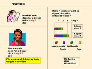 FLUOROSIS
F in excess of 0.1mg/ kg body
weight = fluorosis
Maxium safe
dose for a 5 year
old = 2 mg F /
day
Maxium safe
dose for a 2 year
old = 1 mg F /
day
1 2 3 4 mg F
supplements toothpaste
fluids food
DW Banting
JADA
123:86,1991
Daily F intake of a 20 kg
4 year olds with
different water F
0.5 ppm
water F
1.2 ppm
water F
 