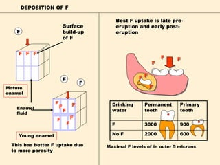 F
F
F
F
This has better F uptake due
to more porosity
DEPOSITION OF F
Best F uptake is late pre-
eruption and early post-
eruption
F
F
F
F
F
F
FF
F
F
F
F
Mature
enamel
Surface
build-up
of F
F
F
F
Enamel
fluid
Young enamel
Drinking
water
Permanent
teeth
Primary
teeth
F 3000 900
No F 2000 600
Maximal F levels of in outer 5 microns
 