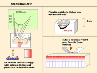 3000
2000
1000
PPM Fluoride
outer 2 microns = 6000
ppm fluoride (max.
uptake)
Fluoride uptake is higher in a
decalcified area
F
5 um
DEPOSITION OF F
CaCa CaCaCa
F F
F
As fluoride reacts strongly
with calcium it does not
penetrate far into the tooth.
3000 ppm F
1500 ppm F
 
