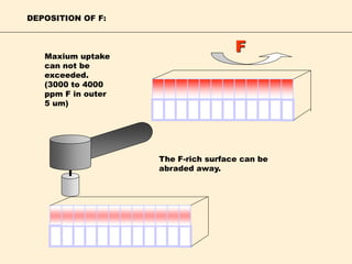 F
DEPOSITION OF F:
Maxium uptake
can not be
exceeded.
(3000 to 4000
ppm F in outer
5 um)
The F-rich surface can be
abraded away.
 