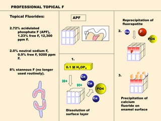 PROFESSIONAL TOPICAL F
2.72% acidulated
phosphate F (APF),
1.23% free F, 12,300
ppm F.
2.0% neutral sodium F,
0.9% free F, 9200 ppm
F.
8% stannous F (no longer
used routinely).
F
0.1 M H3OP4
PO4
Ca
Ca
F
Dissolution of
surface layer
Reprecipitation of
fluorapatite
1.
2.
3.
APF
Ca
Topical Fluorides:
H+
H+
Precipitation of
calcium
fluoride on
enamel surface
Ca
PO4
 