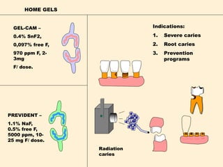 HOME GELS
GEL-CAM –
0.4% SnF2,
0,097% free F,
970 ppm F, 2-
3mg
F/ dose.
PREVIDENT –
1.1% NaF,
0.5% free F,
5000 ppm, 10-
25 mg F/ dose.
Indications:
1. Severe caries
2. Root caries
3. Prevention
programs
Radiation
caries
 