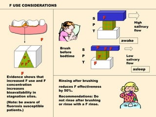 F USE CONSIDERATIONS
F
F
F
F
F
F
Evidence shows that
increased F use and F
concentration
increases
bioavailability in
stagnation sites.
(Note: be aware of
fluorosis susceptible
patients.)
FS
P
T
FS
P
T
F F
F
F
awake
asleep
High
salivary
flow
Low
salivary
flow
Brush
before
bedtime
Rinsing after brushing
reduces F effectiveness
by 50%.
Recommendations: Do
not rinse after brushing
or rinse with a F rinse.
 