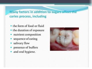 Etiology Of Dental Caries Ppt