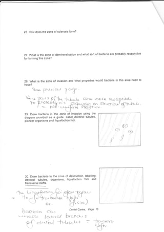 26. How does the zone of sclerosis form?
27 . Nhal is the zone of demineralisation and what sort of bacteria are probably responsible
for forming this zone?
2g. What is the zone of invasion and what properties would bacteria in this area need to
have?
S-!e-
frlui'ocr.s T
*'ff
Qts
.j-"
29. Draw bacteria in'the zone of invasion using the
diagram provided as a guide. Label.dentinal tubules,
pioneer organisms and liquefaction foci.
30. Draw bacteria in the zone of destruction, labelling:
dentinal tubules, organisms, liquefaction foci and
transverse clefts.
ry;FT.':- {t*i}Sa -t'jsfi"''-., 
or ff"ti.,")
bcvcte-n., cc*n ,
Dentatcaries' Pase 10
-l-^ iv'c-Ct.a I a1'e rA-d hcOOCks S,
.Z
P"f cu^rLJ Jr'huJ-t: =
:h*^t('YSe
j
u4 , tu_
tf,
Cl3ruq mo, Fcr- Eara 66p 1. k>tr
c&ne etr */
"61-(.j-U(.l((+(+nc! . )
 