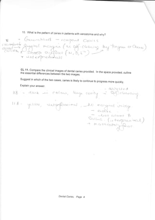 10' what is the pattern of caries in patients with xerostomia and why?
cL11'comparetheclinicalimagesofdentalcariesprovided.
lnthespaceprovided,oulinethe essential differences betweei tfre two images.
suggest in which of the two cases, caries is likely to continue to progress more quickly.
Explain your answer.
1""g""- a, Ch"-o)
a.l)o e-0 e d.
itB
llA ^ ,,-s*LtDtr-
[/
la^f yr-plc;tr, moJ t
,-/
*-ec ,nc---ciriacrt *-r icq
al
cr c*lv q
*--Lc s.S C. C'cec.f
tr
F
fotu"
o (;. *.pr?T-c^;.^.{)*f n cr s,.o_.i#,* *
de;,k ; c o( rrc^,,. /ar.p.o- Cc-vJfc-1 .--
'dl
Dental Caries, page 4
 