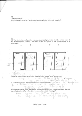 18.
ln enamel caries:
Why is the dark zohe "dark" and how is its width affected by the rate of caries?
CL
19. The given diagram illustrates a carious lesion as it progresses
the dentino-enamel junction. Label each of the four zones of
progresses.
from the earliest stage to
the enamel lesion as it
D
>.F-
:zex/
s r^*t ci*
"TPu-*&h;h "
l)At i,vhat stage of the enamel lesion does the lesion have a "white" appearance?
dYoqr C rLtu +0 htra $ Pf fu rt'bn
<*----r{-
"rir,t*te- qfrc.c'er.( <. -+' *}ot--F" *:: 5'ii) At which stage does the lesion sometirhSs become stained? h ltu-hclt s' 2E7- rr+",
7. J nOqr( {-Lnctr; nr"tn-nd. -|2-{ace. <2c,.-c. q-Dri-r-
J) ' S-$ C c.+cc,.r s S{-c..t'rv
-
qtb-au,^ rp$e .
'F"i6'?":Htn"o"ffi,r:ffi--hifl
fi nction,theresion"[,"uorraterary
along the junction. What colour does the enamel acquire at this stage?
Mcre
ee
orsC.u. oI. DfT N(%{i*-r.'ch
s"Qupt-'ar, JL V)-''"-.*^hJ
(ar *,i)
Dental Caries, Page 7
 