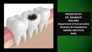 PRESENTED BY:
DR. ANUBHUTI
BDS,MDS
Department of Conservative
Dentistry & Endodontics
DENTAL INSTITUTE
RIMS
 