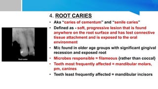 4. ROOT CARIES
• Aka “caries of cementum” and “senile caries”
• Defined as - soft, progressive lesion that is found
anywhere on the root surface and has lost connective
tissue attachment and is exposed to the oral
environment
• M/c found in older age groups with significant gingival
recession and exposed root
• Microbes responsible = filameous {rather than coccal}
• Teeth most frequently affected = mandibular molars,
pm, canines
• Teeth least frequently affected = mandibular incisors
 