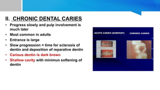 II. CHRONIC DENTAL CARIES
• Progress slowly and pulp involvement is
much later
• Most common in adults
• Entrance is large
• Slow progression = time for sclerosis of
dentin and deposition of reparative dentin
• Carious dentin is dark brown
• Shallow cavity with minimun softening of
dentin
 