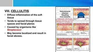 VIII. CELLULITIS
• Diffuse inflammation of the soft
tissue
• Tends to spread through tissue
spaces and facial planes
• Caused by organisms like
Streptococci
• May become localized and result in
facial abcess.
 