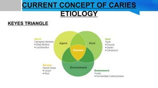 CURRENT CONCEPT OF CARIES
ETIOLOGY
KEYES TRIANGLE
 