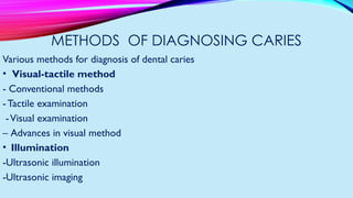 Method Control Caries Dental Caries - Introduction, Theoriesss | PPTX
