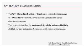 DENTAL CARIES[1].pptx related to dental decay | PPTX