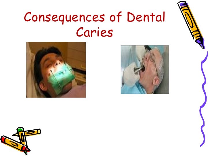 Dental caries ppt