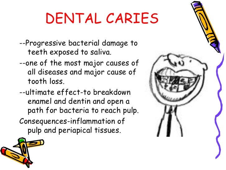 Dental caries ppt