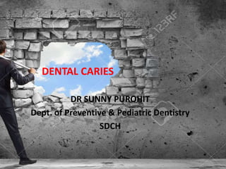 DENTAL CARIES
DR SUNNY PUROHIT
Dept. of Preventive & Pediatric Dentistry
SDCH
 