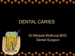 DENTAL CARIES Dr.Manjula Muthuraj BDS. Dental Surgeon 