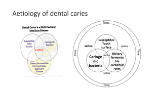 Dental caries , its etiology | PPTX
