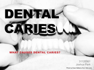 DENTAL
CARIES
WHAT CAUSES DENTAL CARIES?


                                             31120361
                                           Joshua Park
                             Photo by Ewan Bellamy from: flickr.com
 