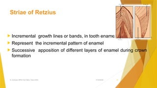 Tooth Retzius DENTAL CARIES lecture description it's prevention | PPTX
