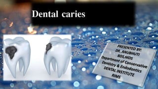 Dental caries
 