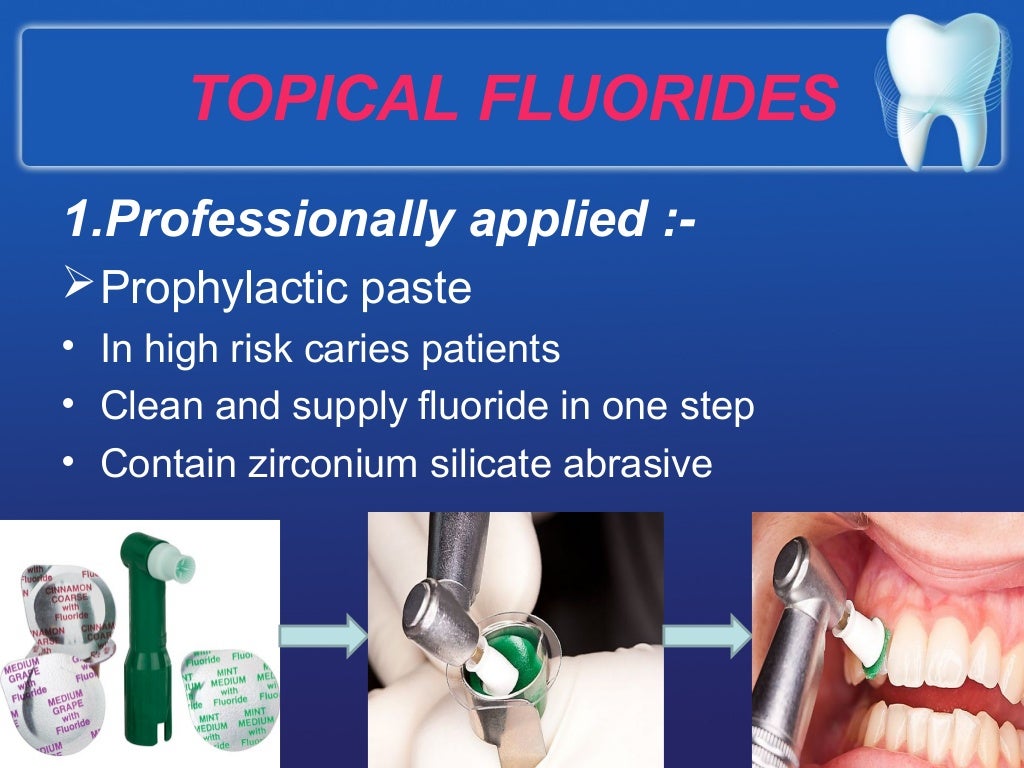 Prevention of dental caries