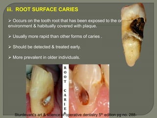 Dental caries (operative dentistry) | PPTX