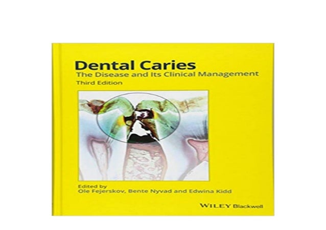 Download Epub Library Dental Caries The Disease And Its Clini