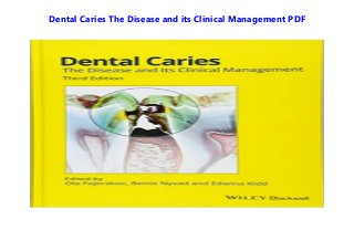 Dental Caries The Disease and its Clinical Management PDF
 