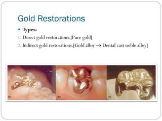 Gold Restorations
 Types:
1. Direct gold restorations.[Pure gold]
2. Indirect gold restorations.[Gold alloy  Dental cast noble alloy]

 