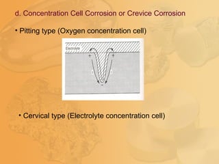 d. Concentration Cell Corrosion or Crevice Corrosion
• Pitting type (Oxygen concentration cell)
• Cervical type (Electrolyte concentration cell)
 