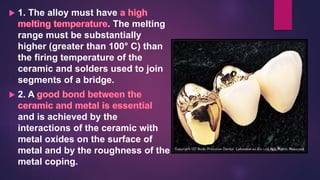  1. The alloy must have
. The melting
range must be substantially
higher (greater than 100° C) than
the firing temperature of the
ceramic and solders used to join
segments of a bridge.
 2. A
and is achieved by the
interactions of the ceramic with
metal oxides on the surface of
metal and by the roughness of the
metal coping.
 