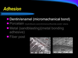 Adhesion Dentin/enamel (micromachanical bond) Porcelain  (hydrofluoric acid,Ammoniumfluoride acid)+ silane Metal (sandblasting)(metal bonding adhesive) Fiber post 